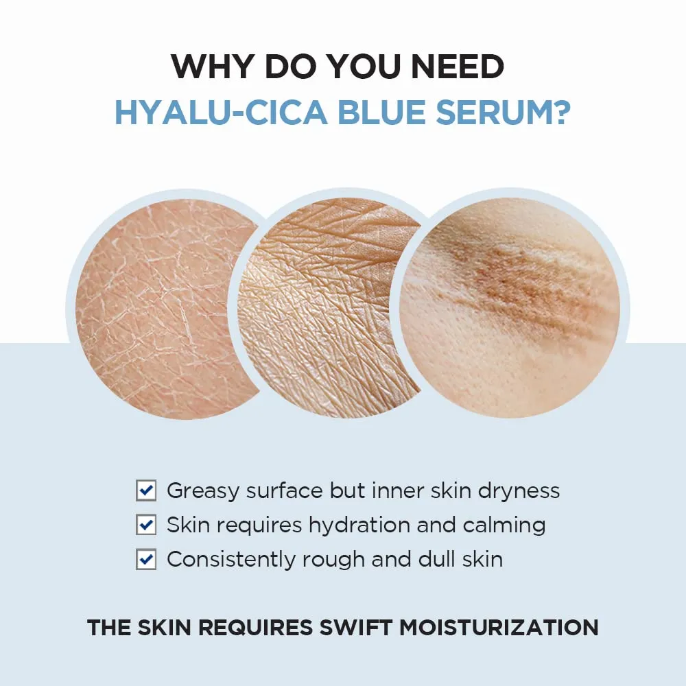 SKIN 1004 Hyalu - Cica Blue Serum - 50ML